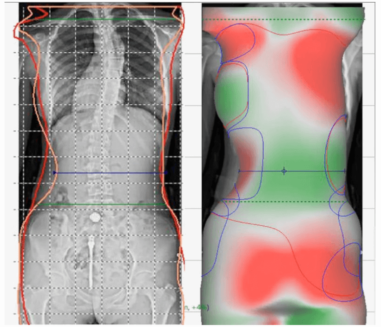 best handheld 3d scanners Aesthetics 