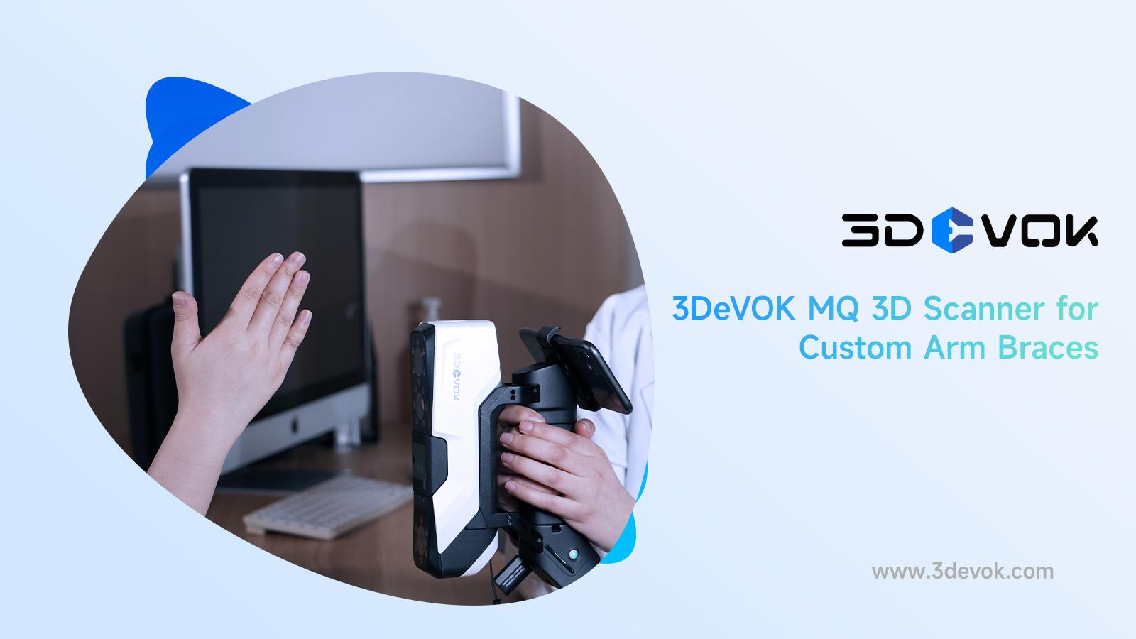 3DeVOK MQ 3D Scanner for Custom Arm Braces